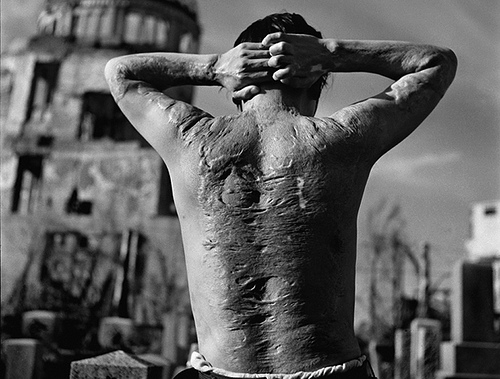 Por la bomba atómica arrojada por Estados Unidos en 1945 sobre Hiroshima murieron 145.000 personas y varios cientos de miles sufrieron lesiones y enfermedades graves en las seis décadas posteriores
