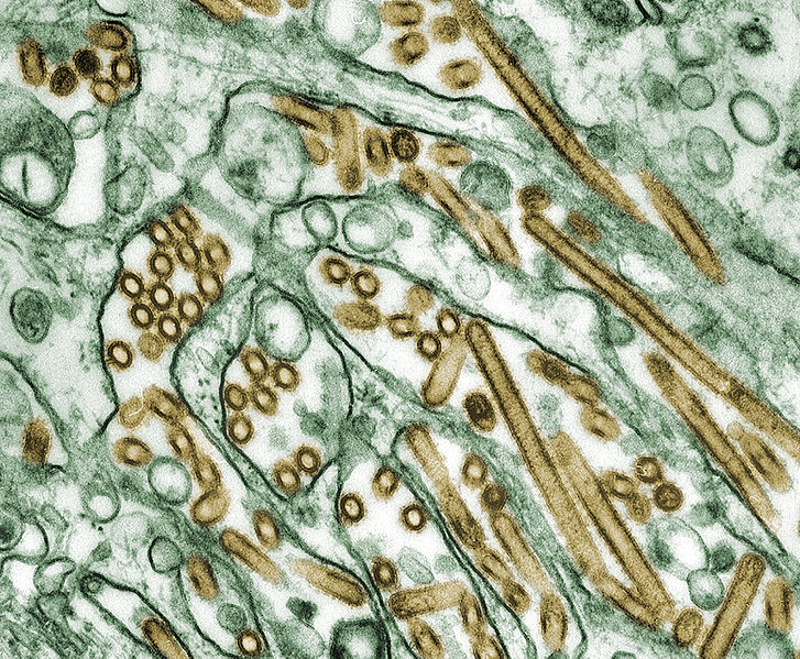 Vírus inluenza H5N1 (em amarelo) atacando as células MDCK (em verde).
