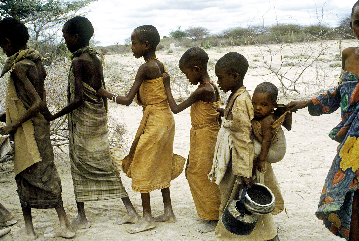 Голодный народ. Сомали 1992 год фото голодающих. Голодающие дети Сомали.