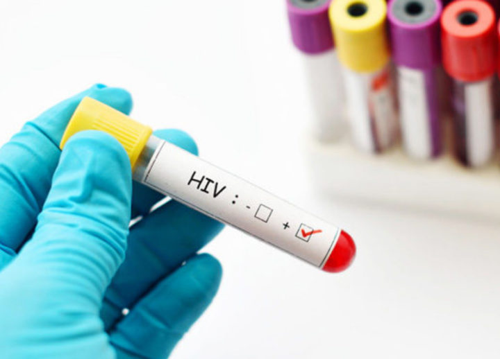 İtalya | “HIV aşısına çok yakınız”