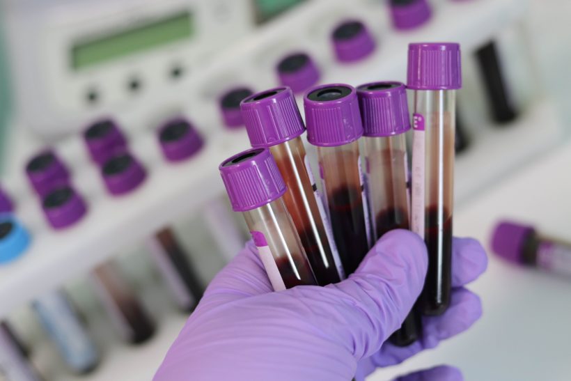 Blutproben zur Analyse im Labor